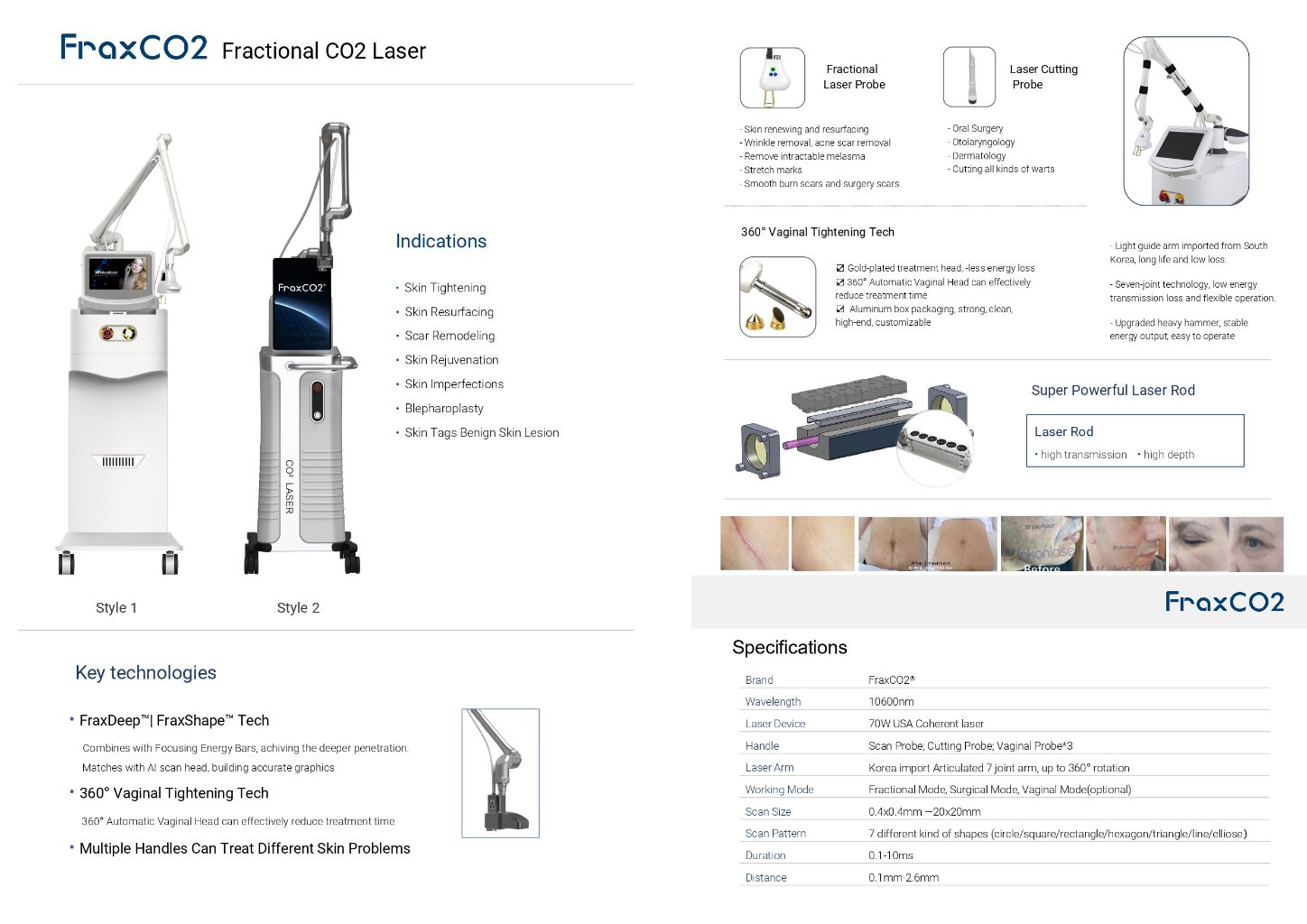 Segmented CO2 Laser Beauty Device